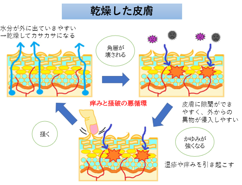 アトピー性皮膚炎