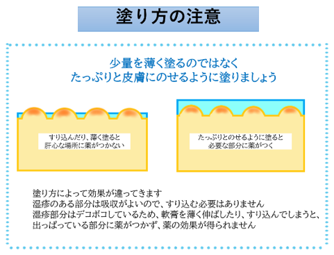 アトピー性皮膚炎