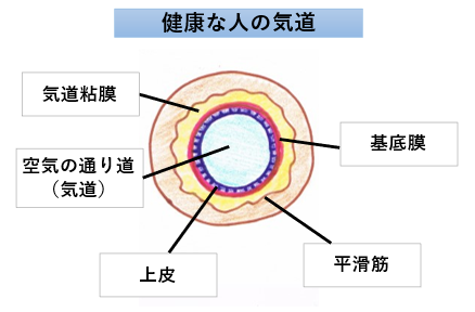 気管支喘息