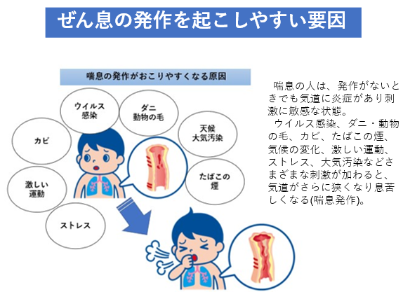 気管支喘息